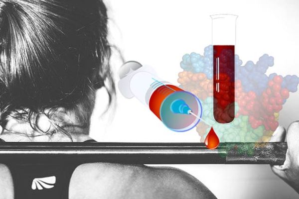 Uso proprio ed uso improprio dei Farmaci nello Sport