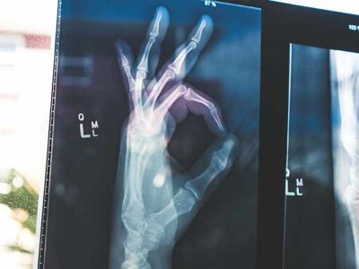 Osteopatia Funzionale e sport