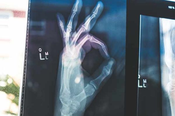 Osteopatia Funzionale e sport